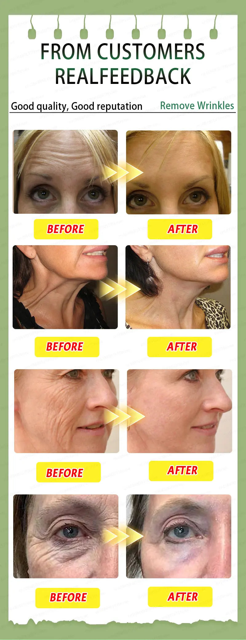 POZOAMIS Anti-Aging Serum – Advanced Wrinkle Treatment Combo